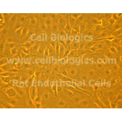 ZDF Rat Diabetic Mammary Microvascular Endothelial Cells